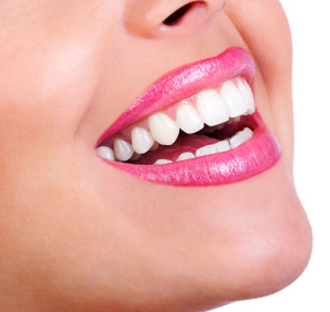 teeth-whitening-doon-south-dental-kitchener